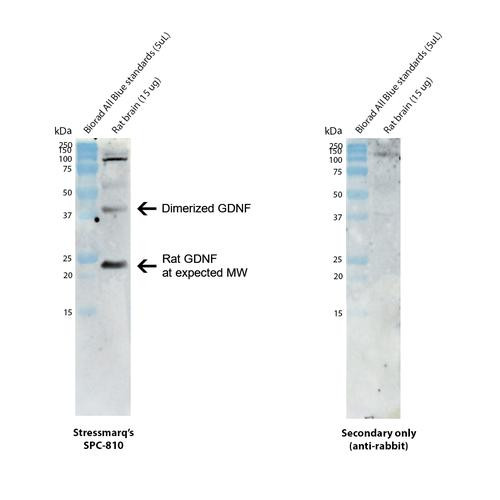 Western blot analysis with anti-GDNF polyclonal antibody (STPA00090) showing detection of GDNF protein in rat brain lysate (prepared in-house). Rat GNDF protein with signal and pro-peptide segments has a predicted molecular weight of 23.6 kDa (UniProt Q07731). Block: 5% skim milk. Primary Antibody: Rabbit Anti-GDNF Polyclonal Antibody (STPA00090) at 1:1000 for 2 hours at RT.