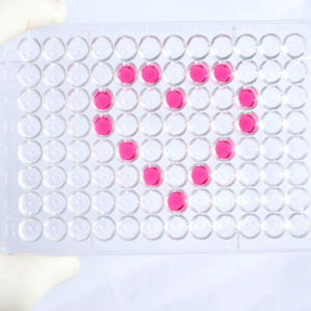 Human HLA class I histocompatibility antigen, B-27 alpha chain (HLA-B27) ELISA Kit