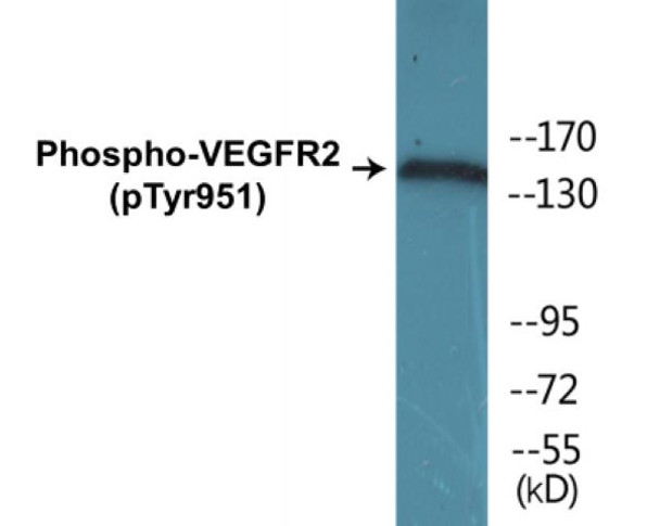 VEGFR2 (Phospho-Tyr951) Colorimetric Cell-Based ELISA Kit