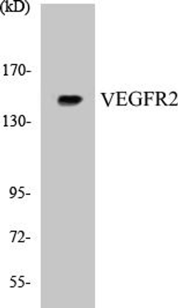 VEGFR2 Colorimetric Cell-Based ELISA Kit