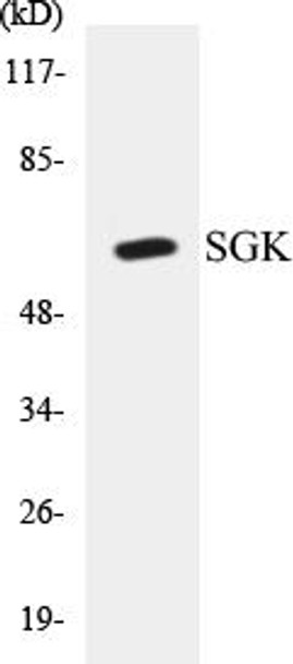 SGK Colorimetric Cell-Based ELISA Kit