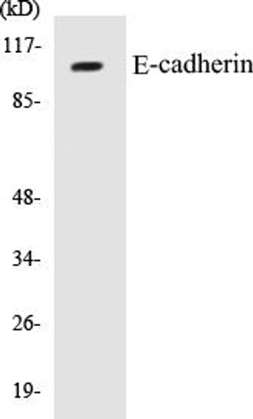 E-cadherin Colorimetric Cell-Based ELISA Kit