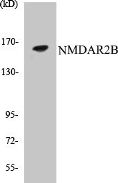 NMDAR2B Colorimetric Cell-Based ELISA Kit