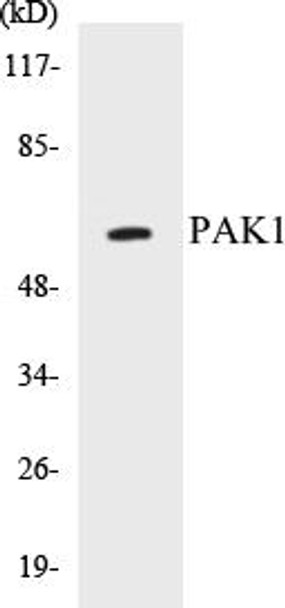 PAK1 Colorimetric Cell-Based ELISA Kit