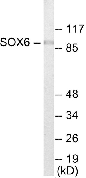 SOX6 Colorimetric Cell-Based ELISA