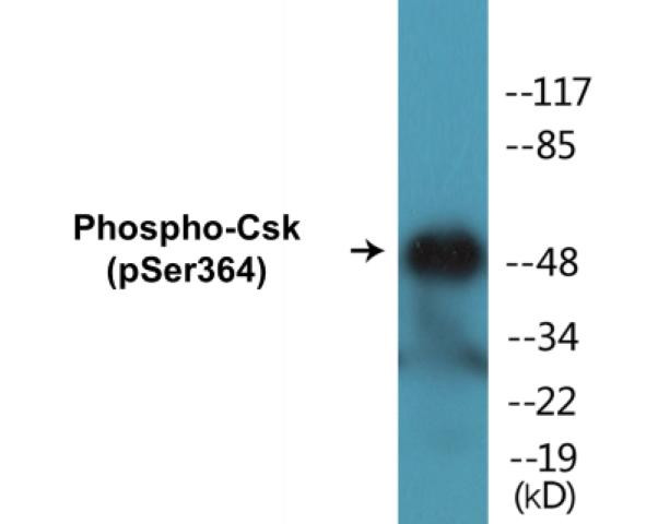 Csk (Phospho-Ser364) Colorimetric Cell-Based ELISA Kit