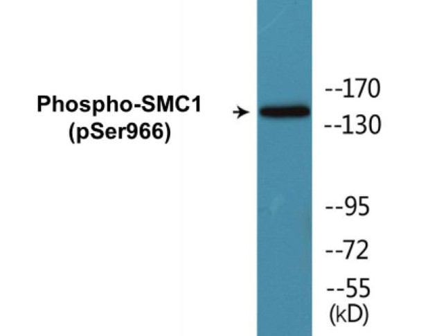 SMC1 (Phospho-Ser966) Colorimetric Cell-Based ELISA Kit