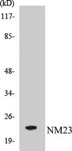 NM23 Colorimetric Cell-Based ELISA Kit