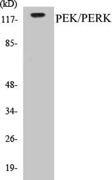 PEK/PERK Colorimetric Cell-Based ELISA Kit