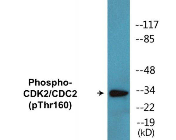 CDK2 (Phospho-Thr160) Colorimetric Cell-Based ELISA Kit
