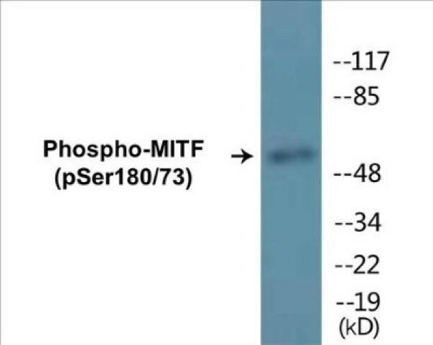 MITF (Phospho-Ser180/73) Colorimetric Cell-Based ELISA Kit