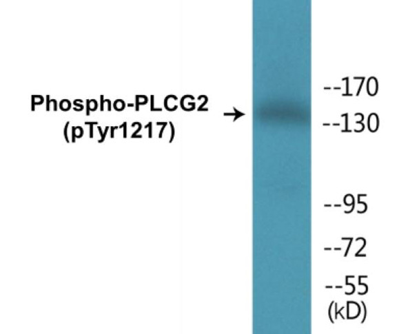 PLCG2 (Phospho-Tyr1217) Colorimetric Cell-Based ELISA Kit