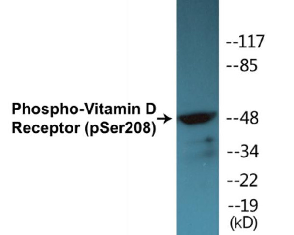 Vitamin D Receptor (Phospho-Ser208) Colorimetric Cell-Based ELISA Kit