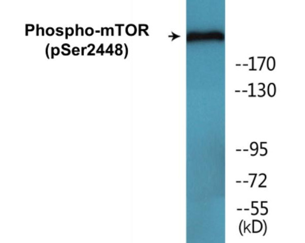 mTOR (Phospho-Ser2448) Colorimetric Cell-Based ELISA Kit