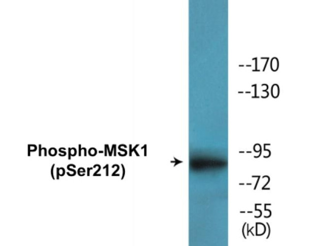 MSK1 (Phospho-Ser212) Colorimetric Cell-Based ELISA Kit