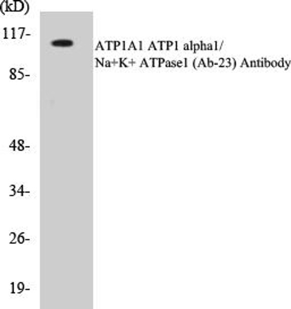 ATP1A1 Colorimetric Cell-Based ELISA Kit