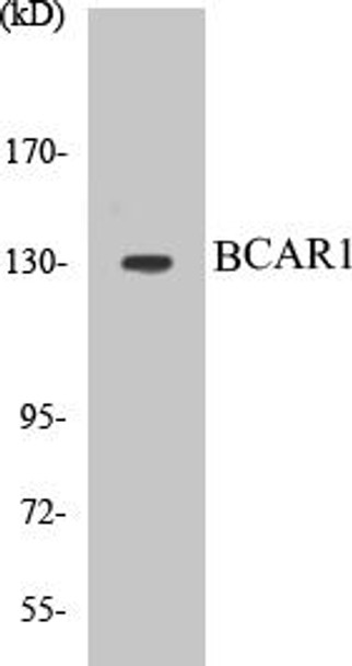 BCAR1 Colorimetric Cell-Based ELISA Kit