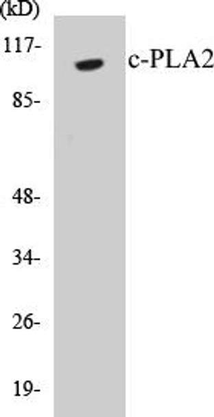 c-PLA2 Colorimetric Cell-Based ELISA Kit