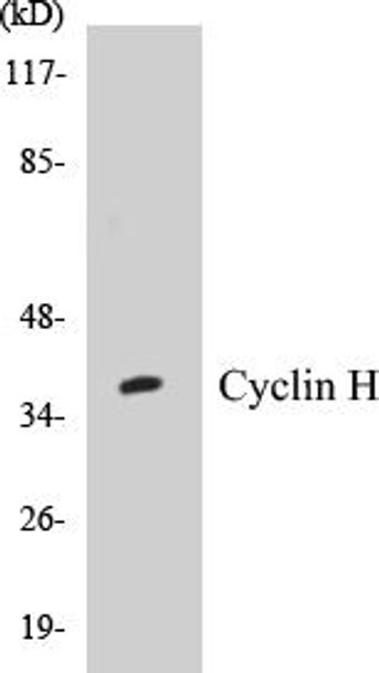 Cyclin H Colorimetric Cell-Based ELISA Kit