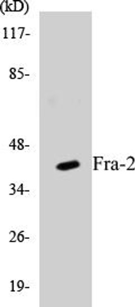 Fra-2 Colorimetric Cell-Based ELISA Kit