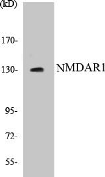 NMDAR1 Colorimetric Cell-Based ELISA Kit