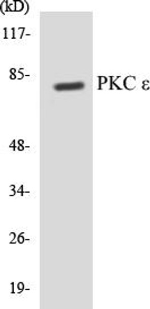 PKC epsilon Colorimetric Cell-Based ELISA Kit