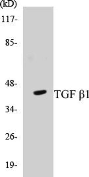 TGF beta1 Colorimetric Cell-Based ELISA Kit