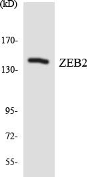 ZEB2 Colorimetric Cell-Based ELISA