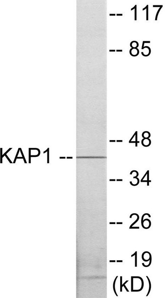 KAP1 Colorimetric Cell-Based ELISA