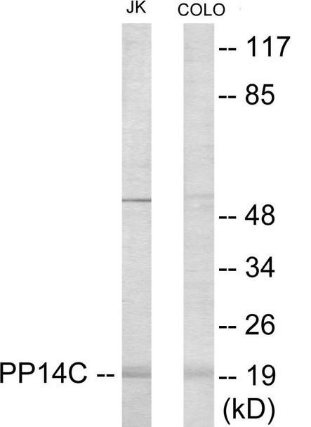 PPP1R14C Colorimetric Cell-Based ELISA