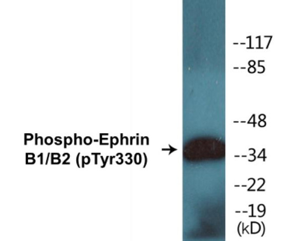Ephrin B1/B2 (Phospho-Tyr330) Colorimetric Cell-Based ELISA Kit