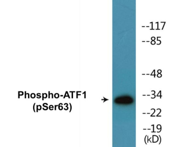 ATF1 (Phospho-Ser63) Colorimetric Cell-Based ELISA Kit