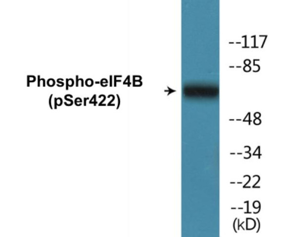eIF4B (Phospho-Ser422) Colorimetric Cell-Based ELISA Kit