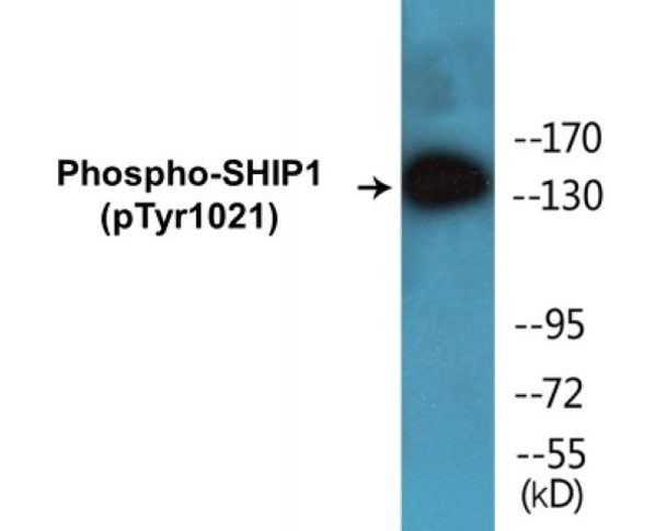 SHIP1 (Phospho-Tyr1021) Colorimetric Cell-Based ELISA Kit