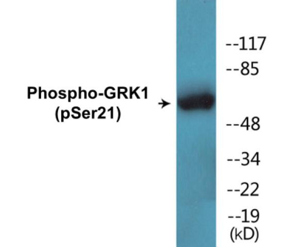 GRK1 (Phospho-Ser21) Colorimetric Cell-Based ELISA Kit