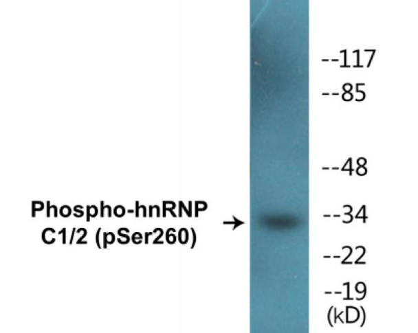 hnRNP C1/2 (Phospho-Ser260) Colorimetric Cell-Based ELISA Kit