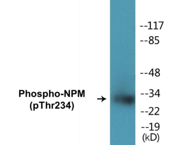 NPM (Phospho-Thr234) Colorimetric Cell-Based ELISA Kit