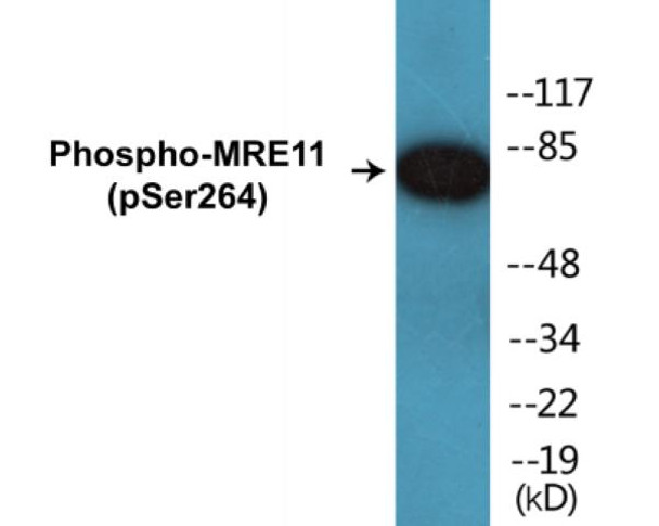 MRE11 (Phospho-Ser264) Colorimetric Cell-Based ELISA Kit