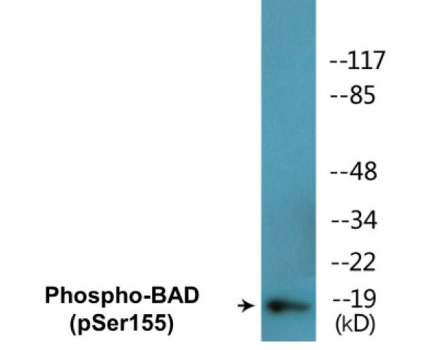 BAD (Phospho-Ser155) Colorimetric Cell-Based ELISA Kit