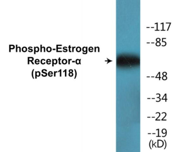 Estrogen Receptor-alpha (Phospho-Ser118) Colorimetric Cell-Based ELISA Kit