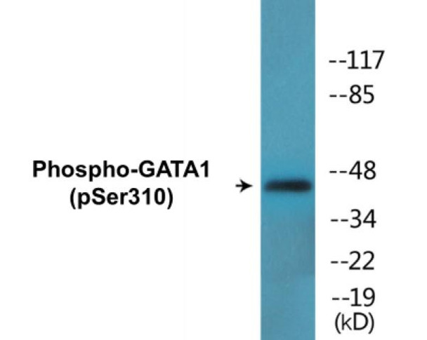 GATA1 (Phospho-Ser310) Colorimetric Cell-Based ELISA Kit