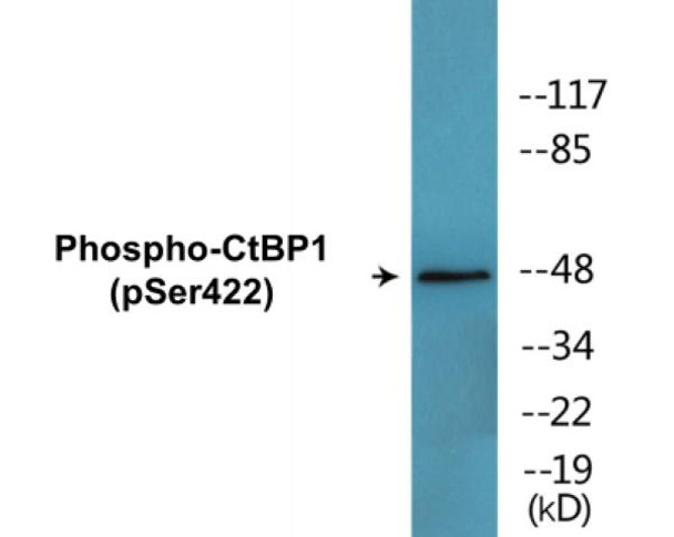 CtBP1 (Phospho-Ser422) Colorimetric Cell-Based ELISA Kit