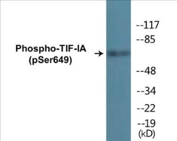 TIF-IA (Phospho-Ser649) Colorimetric Cell-Based ELISA Kit