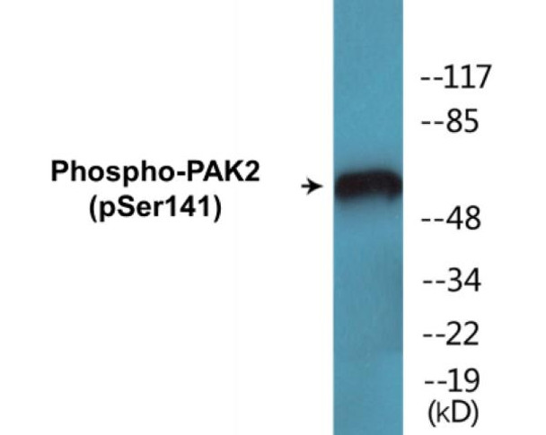 PAK2 (Phospho-Ser141) Fluorometric Cell-Based ELISA Kit
