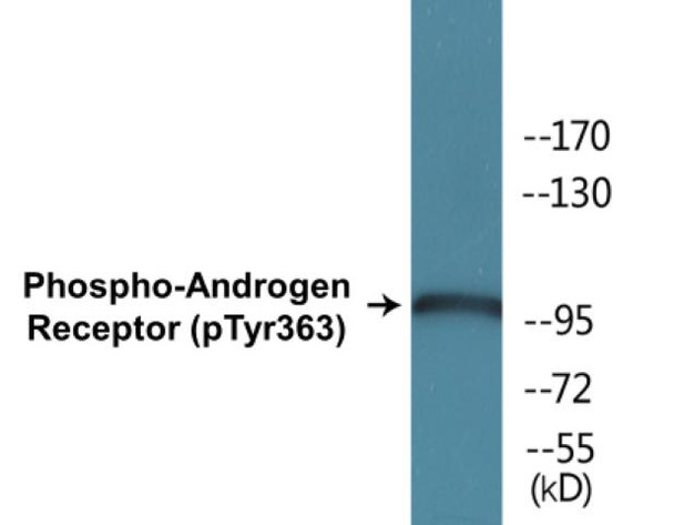 Androgen Receptor (Phospho-Tyr363) Fluorometric Cell-Based ELISA Kit