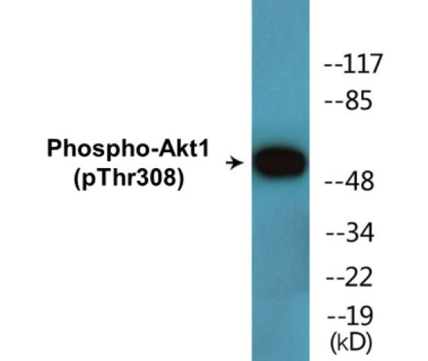 Akt1 (Phospho-Thr308) Fluorometric Cell-Based ELISA Kit
