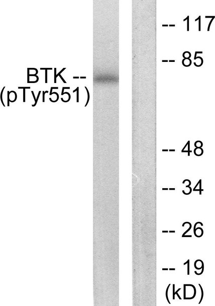 BTK (Phospho-Tyr551) Fluorometric Cell-Based ELISA Kit