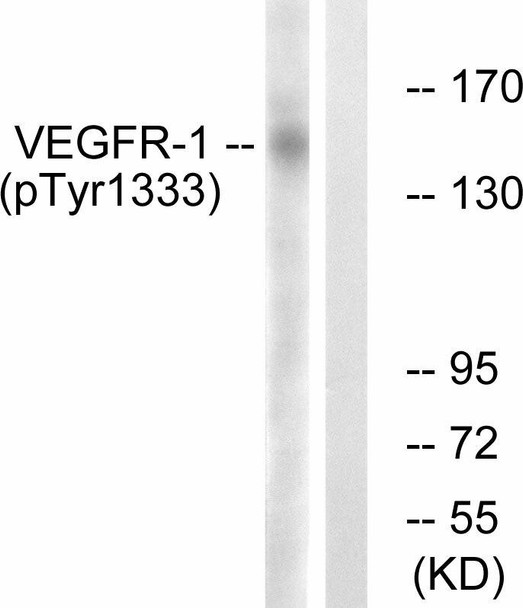 VEGFR1 (Phospho-Tyr1333) Fluorometric Cell-Based ELISA Kit