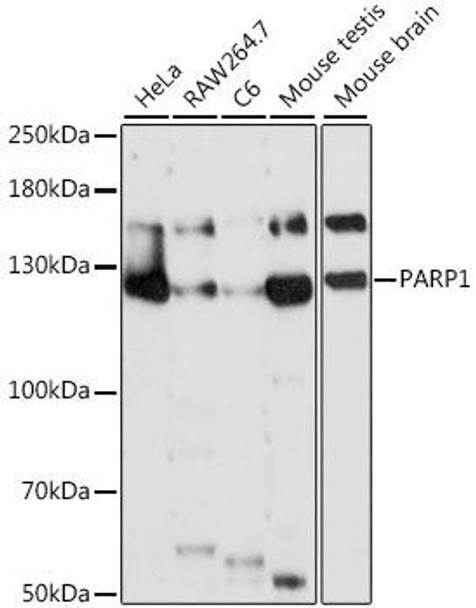 Anti-PARP1 Antibody (CAB0010)