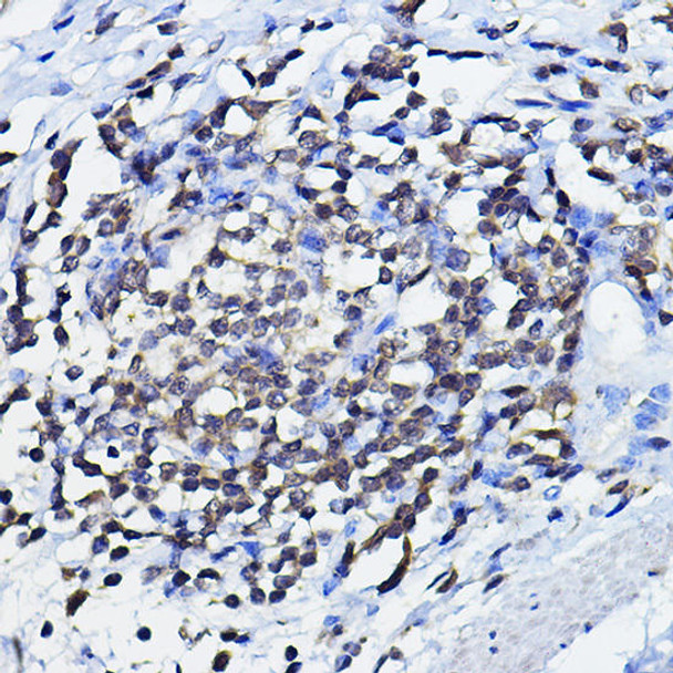 Anti-TP73 Antibody (CAB0385)